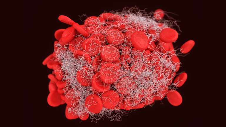 a 3d illustration of a blood clot