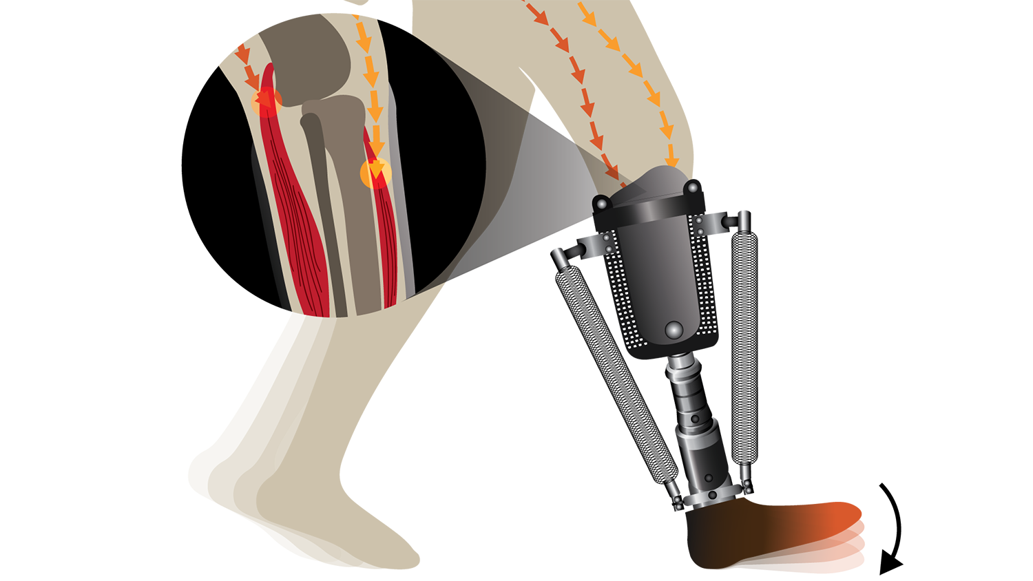 biomedical engineering prosthetic limbs